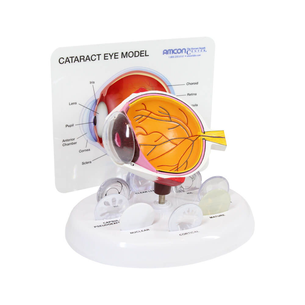 Cataract Eye Model - 1
