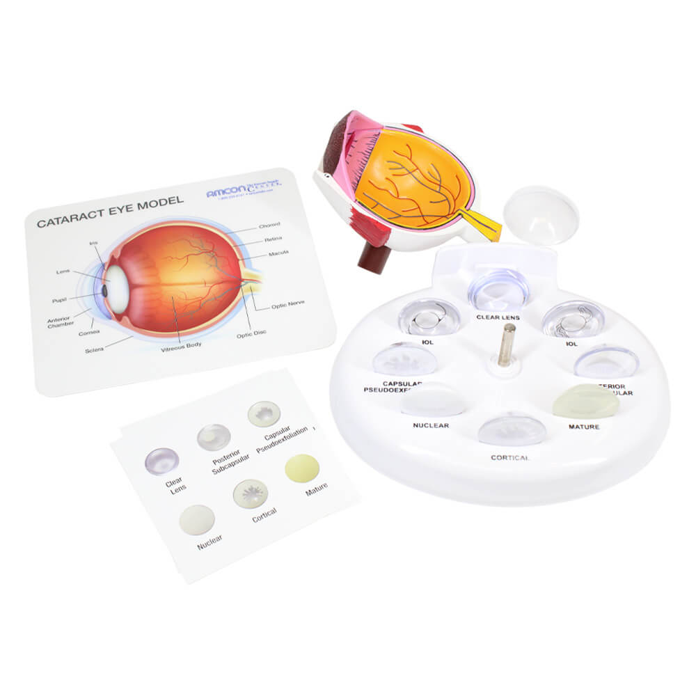 Cataract Eye Model - 3