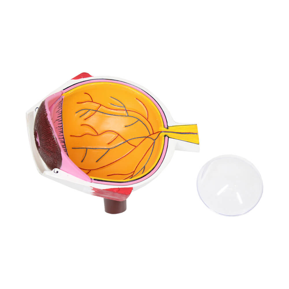 Cataract Eye Model - 7