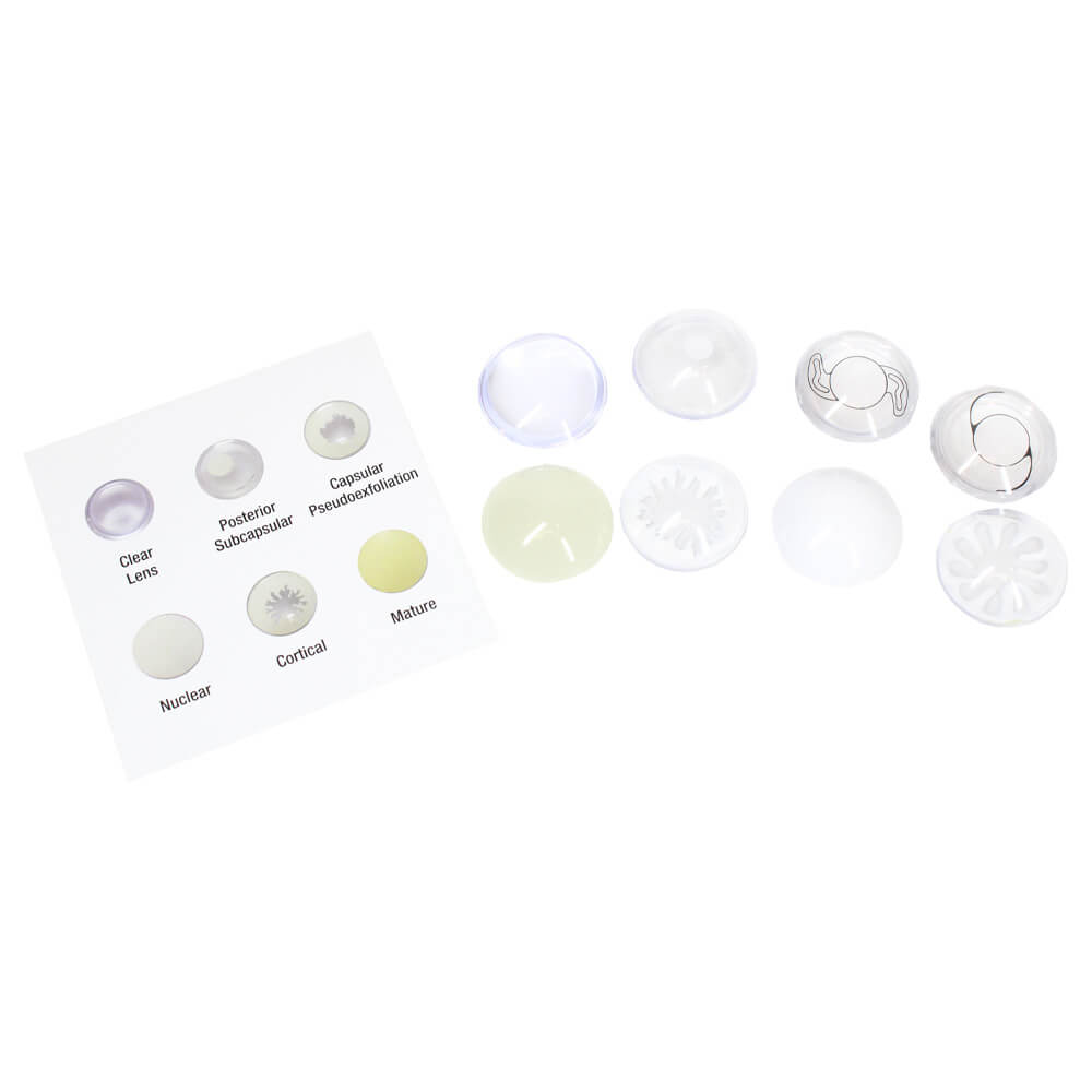 Cataract Eye Model - 9